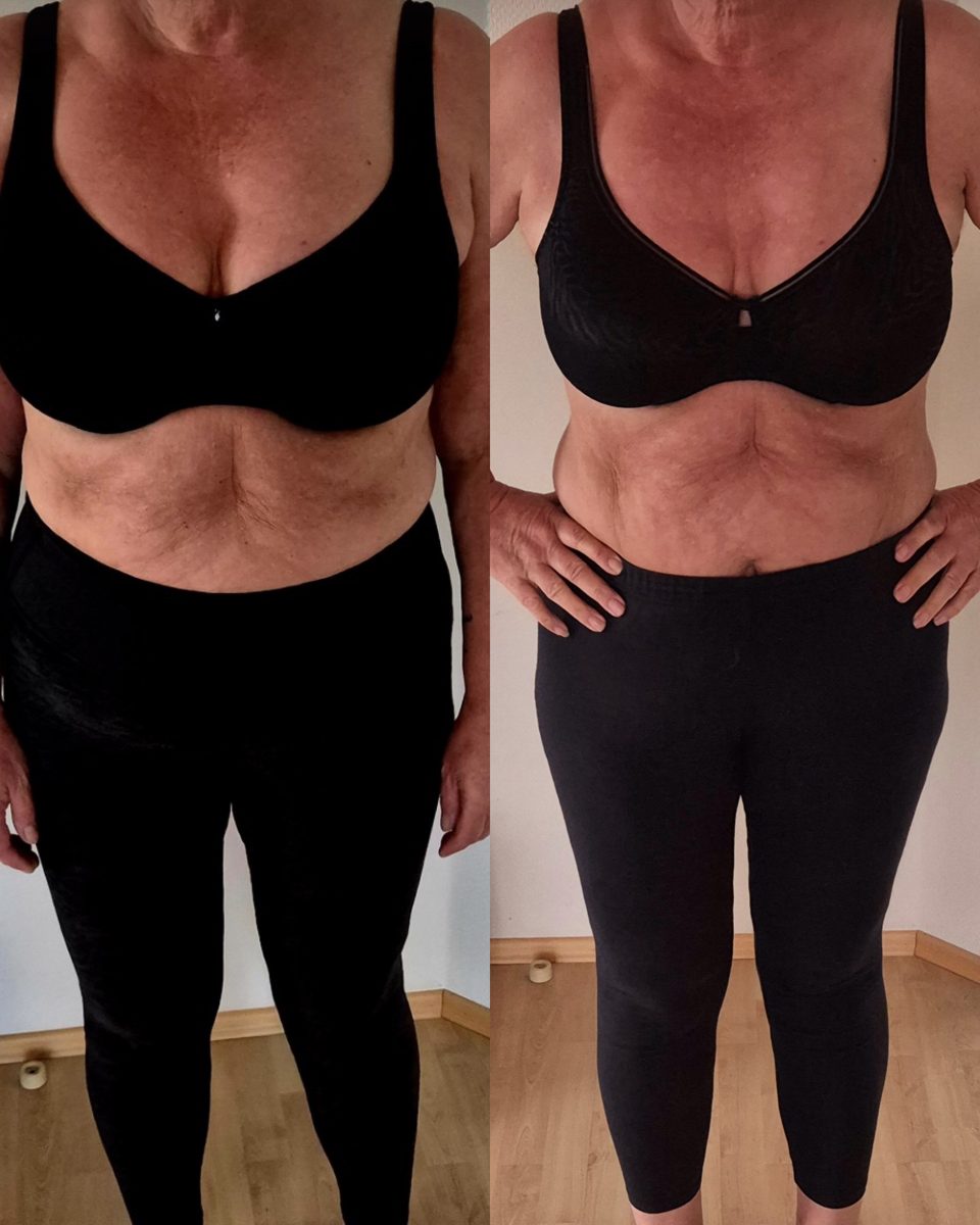 Vorher-Nachher Transformation einer Kundin