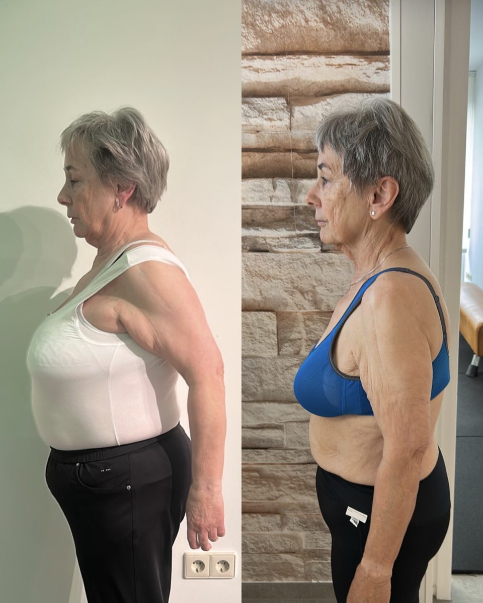 Vorher-Nachher Transformation einer Kundin